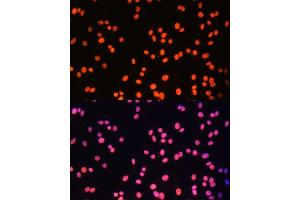 Immunofluorescence analysis of C6 cells using ZNF581 Polyclonal Antibody (ABIN6128960, ABIN6150520, ABIN6150521 and ABIN6217055) at dilution of 1:100 (40x lens). (ZNF581 Antikörper  (AA 1-90))