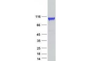 Validation with Western Blot