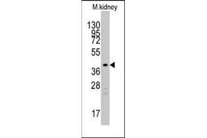 Western blot analysis of anti-TBRG1 Pab in mouse kidney tissue lysates (35ug/lane). (TBRG1 Antikörper  (N-Term))