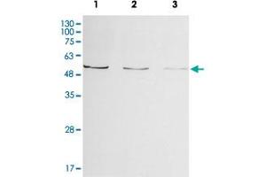 Western blot analysis of Enpp2 from zebrafish embryo lysate by Enpp2 polyclonal antibody ( Cat # PAB8520 ) (1:500, 4°C, overnight). (ENPP2 Antikörper)