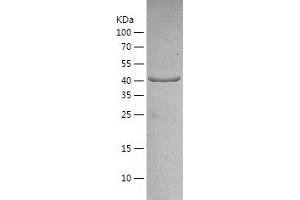 Western Blotting (WB) image for Glial Fibrillary Acidic Protein (GFAP) (AA 1-430) protein (His tag) (ABIN7123095) (GFAP Protein (AA 1-430) (His tag))