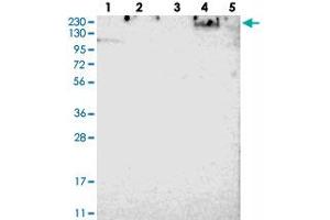 Western blot analysis of Lane 1: RT-4, Lane 2: U-251 MG, Lane 3: Human Plasma, Lane 4: Liver, Lane 5: Tonsil with SPTBN1 polyclonal antibody . (SPTBN1 Antikörper)