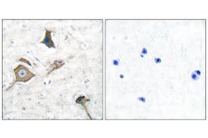 Immunohistochemistry (IHC) image for anti-Matrix Metallopeptidase 16 (Membrane-inserted) (MMP16) (C-Term) antibody (ABIN1848679) (MMP16 Antikörper  (C-Term))