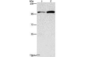 Western blot analysis of HepG2 and K562 cell, using CDC27 Polyclonal Antibody at dilution of 1:750 (CDC27 Antikörper)