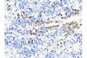 Immunohistochemistry of paraffin-embedded rat spleen using S100A9 antibody. (S100A9 Antikörper)