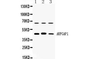 Western blot analysis of ARFGAP1 expression in rat brain extract ( Lane 1), mouse brain extract ( Lane 2) and HELA whole cell lysates ( Lane 3).