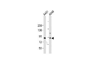 All lanes : Anti-Dnmt3b Antibody  at 1:2000 dilution Lane 1: A431 whole cell lysates Lane 2: A549 whole cell lysates Lysates/proteins at 20 μg per lane. (DNMT3B Antikörper  (AA 389-417))