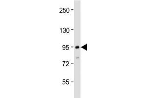 Western blot testing of human MCF7 cell lysate with TGFBR3 antibody at 1:2000. (TGFBR3 Antikörper  (N-Term))