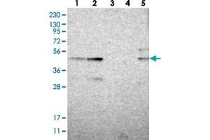 Western blot analysis of Lane 1: RT-4, Lane 2: U-251 MG, Lane 3: Human Plasma, Lane 4: Liver, Lane 5: Tonsil with ZNF397OS polyclonal antibody  at 1:250-1:500 dilution.
