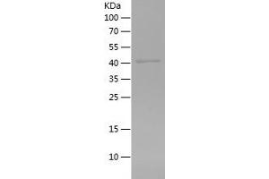 Western Blotting (WB) image for Alanyl (Membrane) Aminopeptidase (ANPEP) (AA 34-381) protein (His tag) (ABIN7121764) (CD13 Protein (AA 34-381) (His tag))