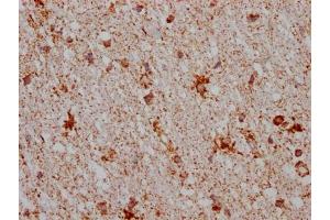 IHC image of ABIN7127628 diluted at 1:100 and staining in paraffin-embedded human brain tissue performed on a Leica BondTM system. (Rekombinanter Monoamine Oxidase B Antikörper)