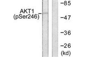Western blot analysis of extracts from HeLa cells treated with Etoposide 25uM 24h, using Akt (Phospho-Ser246) Antibody. (AKT1 Antikörper  (pSer246))