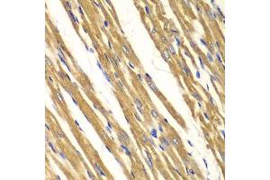 Immunohistochemistry (Paraffin-embedded Sections) (IHC (p)) image for anti-Superoxide Dismutase 2, Mitochondrial (SOD2) (AA 25-222) antibody (ABIN3021904)