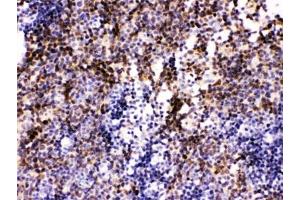 IHC testing of FFPE mouse lymph node with PAX2 antibody.
