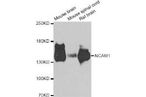 Western blot analysis of extracts of various cell lines, using NCAM1 antibody (ABIN5975670) at 1/1000 dilution. (CD56 Antikörper)