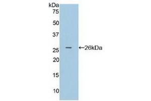 Detection of Recombinant FcgRI, Human using Polyclonal Antibody to Cluster Of Differentiation 64 (CD64) (FCGR1A Antikörper  (AA 35-235))