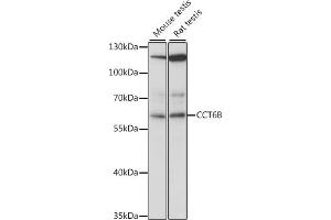 Western blot analysis of extracts of various cell lines, using CCT6B antibody (ABIN7270709) at 1:1000 dilution. (CCT6B Antikörper  (AA 120-340))