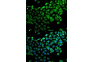 Immunofluorescence (IF) image for anti-Synaptotagmin Binding, Cytoplasmic RNA Interacting Protein (SYNCRIP) (AA 1-200) antibody (ABIN6148764)