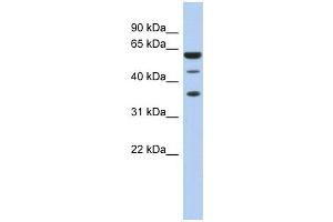 RDBP antibody used at 1 ug/ml to detect target protein. (RDBP Antikörper  (N-Term))