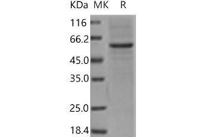 Western Blotting (WB) image for Mannose-Binding Lectin (Protein A) 1 (Mbl1) protein (Fc Tag) (ABIN7321168)