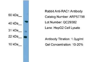 WB Suggested Anti-RAC1  Antibody Titration: 0. (RAC1 Antikörper  (Middle Region))