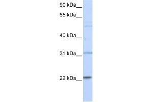 WB Suggested Anti-CDC42 Antibody Titration:  0. (CDC42 Antikörper  (N-Term))