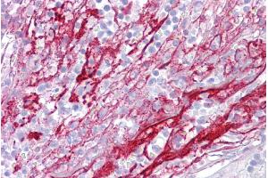 Immunohistochemistry with Tonsil tissue at an antibody concentration of 5µg/ml using anti-APOH antibody (ARP51159_P050) (APOH Antikörper  (Middle Region))