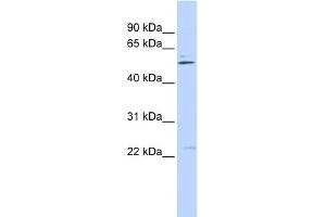 WB Suggested Anti-TRIM35 Antibody Titration:  0. (TRIM35 Antikörper  (Middle Region))