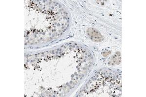 Immunohistochemical staining of human testis with C9orf11 polyclonal antibody  shows strong cap like cytoplasmic positivity in spermatids at 1:200-1:500 dilution. (C9orf11 Antikörper)