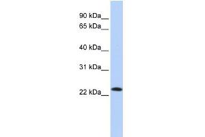 WB Suggested Anti-SDF2 Antibody Titration:  0.
