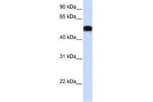 WB Suggested Anti-FOXA1 Antibody Titration: 0. (FOXA1 Antikörper  (N-Term))