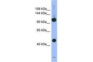 Image no. 1 for anti-Proteasome (Prosome, Macropain) 26S Subunit, Non-ATPase, 1 (PSMD1) (AA 107-156) antibody (ABIN6741701)
