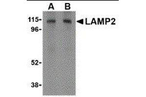 Western Blotting (WB) image for anti-Lysosomal-Associated Membrane Protein 2 (LAMP2) (C-Term) antibody (ABIN2478099) (LAMP2 Antikörper  (C-Term))