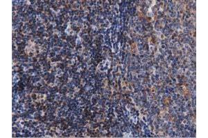 Immunohistochemical staining of paraffin-embedded Human lymph node tissue using anti-ARHGAP25 mouse monoclonal antibody. (ARHGAP25 Antikörper)