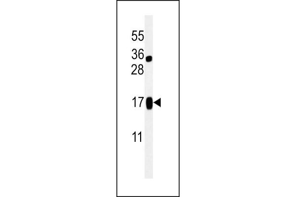 LIMD2 Antikörper  (N-Term)