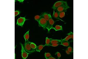 Immunofluorescence (IF) image for anti-Keratin 8 (KRT8) antibody (ABIN6939883)