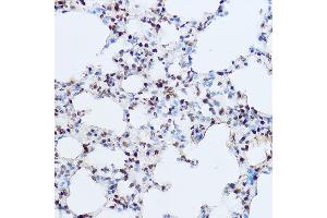 Immunohistochemistry (IHC) image for anti-O-Linked N-Acetylglucosamine (GlcNAc) Transferase (UDP-N-Acetylglucosamine:polypeptide-N-Acetylglucosaminyl Transferase) (OGT) (AA 857-1036) antibody (ABIN3022708)