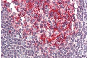 Human Small Intestine, Peyer's Patch (formalin-fixed, paraffin-embedded) stained with BIRC8 antibody ABIN214413 at 5 ug/ml followed by biotinylated goat anti-rabbit IgG secondary antibody ABIN481713, alkaline phosphatase-streptavidin and chromogen.