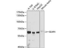 Western blot analysis of extracts of various cell lines, using GLMN antibody (ABIN6129016, ABIN6141133, ABIN6141134 and ABIN6215585) at 1:3000 dilution. (GLMN Antikörper  (AA 405-594))