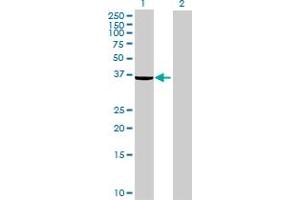 Western Blot analysis of EPM2A expression in transfected 293T cell line ( H00007957-T01 ) by EPM2A MaxPab polyclonal antibody.