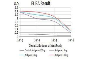 Black line: Control Antigen (100 ng),Purple line: Antigen (10 ng), Blue line: Antigen (50 ng), Red line:Antigen (100 ng)