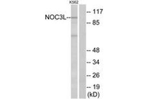 Western blot analysis of extracts from K562 cells, using NOC3L Antibody. (NOC3L Antikörper  (AA 415-464))