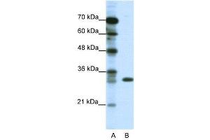 WB Suggested Anti-TSFM  Antibody Titration: 1. (TSFM Antikörper  (C-Term))