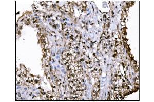 IHC analysis of KMT1B/SUV39H2 using anti-KMT1B/SUV39H2 antibody (ABIN7602135). (SUV39H2 Antikörper  (AA 6-410))