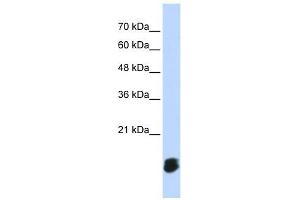 GLRX5 antibody used at 1 ug/ml to detect target protein. (GLRX5 Antikörper  (Middle Region))