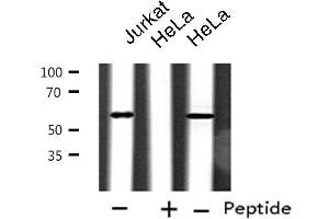 Western blot analysis of extracts from Jurkat/HeLa cells, using CYP2A6V2 antibody. (Cytochrome P450 2A6V2 Antikörper)
