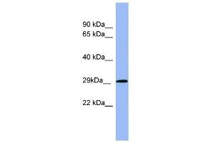 WB Suggested Anti-RAB5A Antibody Titration: 0. (RAB5 Antikörper  (Middle Region))