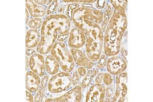 Immunohistochemistry (IHC) image for anti-Ubiquitin Specific Peptidase 9, Y-Linked (USP9Y) antibody (ABIN7271171)
