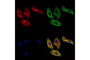 ABIN6264216 and ABIN6273297 staining Hela cells by IF/ICC. (PIK3IP1 Antikörper  (N-Term))