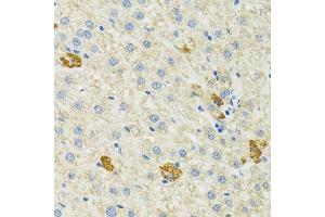 Immunohistochemistry (Paraffin-embedded Sections) (IHC (p)) image for anti-Heat Shock 70kDa Protein 9 (Mortalin) (HSPA9) (AA 380-679) antibody (ABIN3021000)